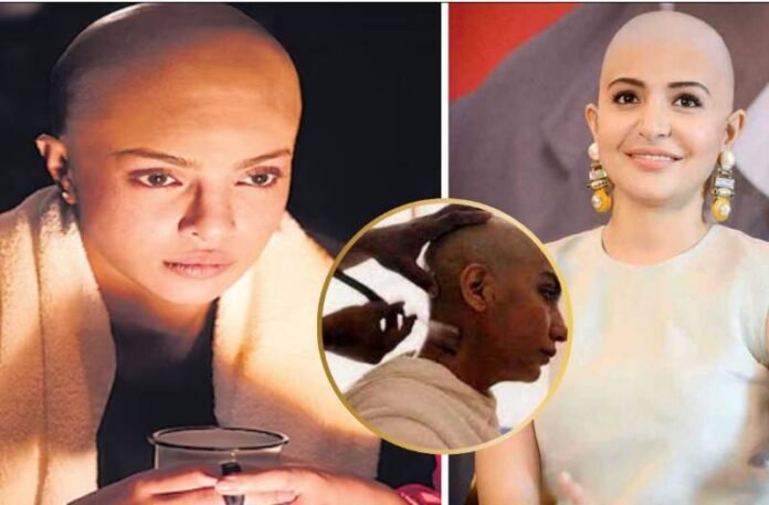 Actress Goes Bald For Movies