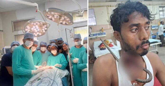 ले में धंस गया 11 इंच लंबा लोहे का सरिया